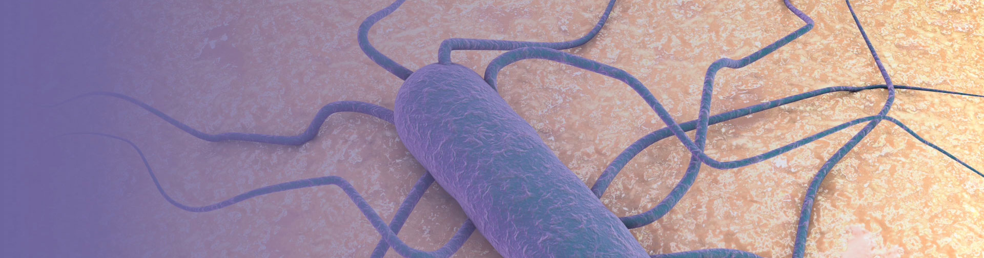 Listeria Monocytogenes